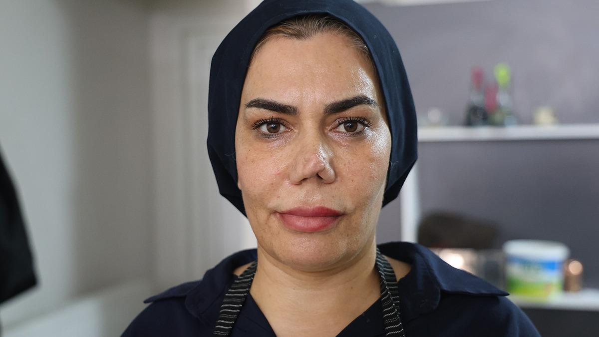 Burnu kırıldı,